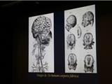 L’histoire de la neurochirurgie